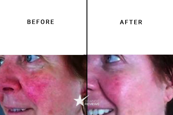 Frank Body Face Scrub Before and After