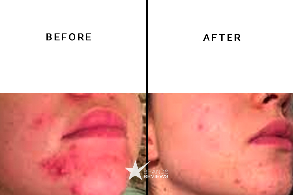 Fresh Clay Mask Before and After