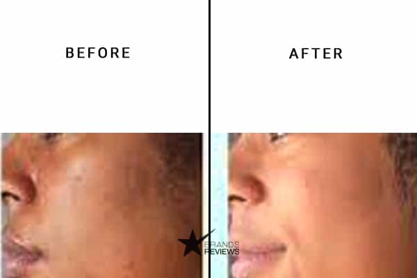 Garnier Face Moisturizer Before and After