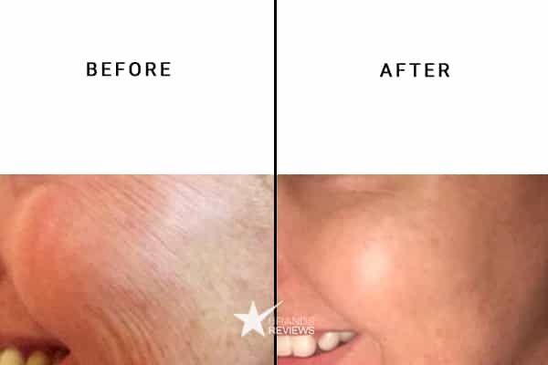 Glamglow Collagen Serum Before and After