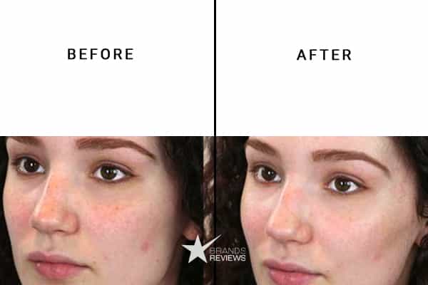 Glow Recipe Face Moisturizer Before and After