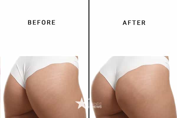 Gluteboost Butt Enhancement Cream Before and After