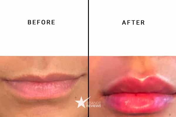 Grande Lip Plumper Before and After