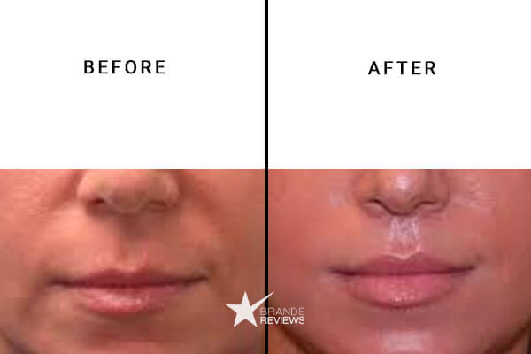 Hello CBD Lip Balm Before and After