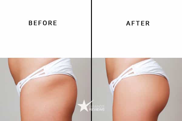 Honeydew Products Butt Enhancement Before and After