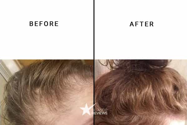 HUM Nutrition Hair Gummies Before and After