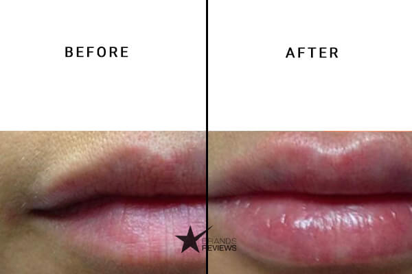 im.bue CBD Lip Balm Before and After