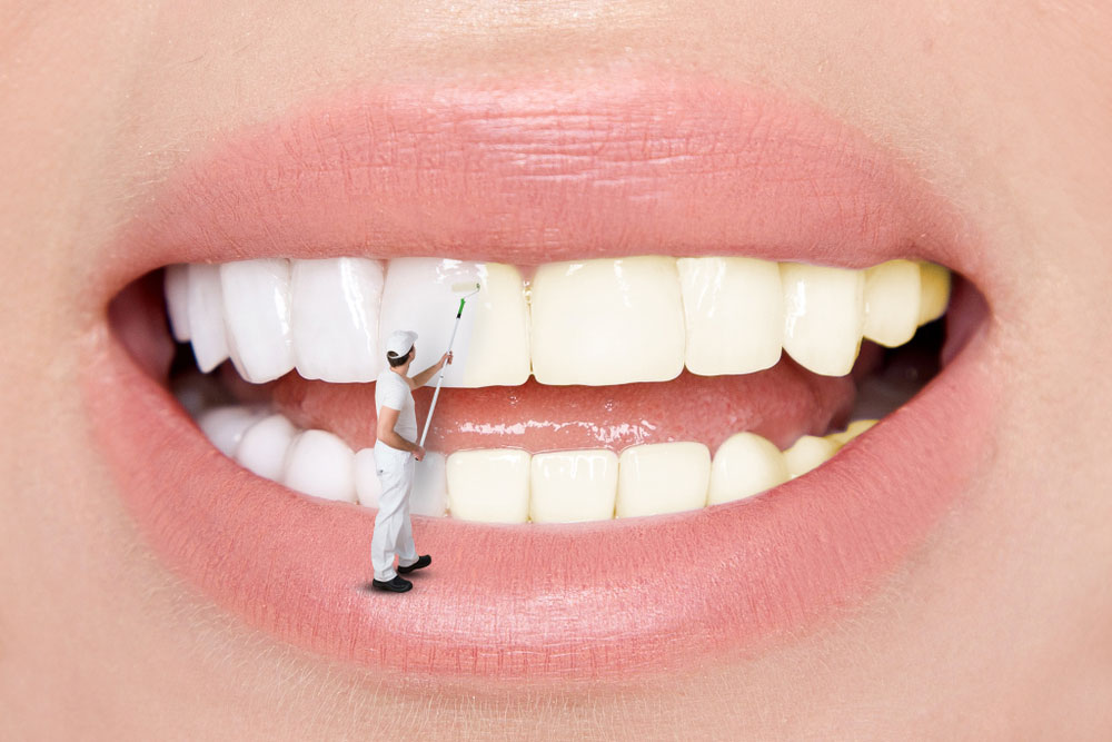 about teeth whitening