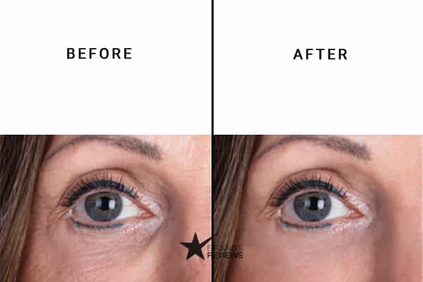 Instantly Ageless Anti-Aging Serum Before and After