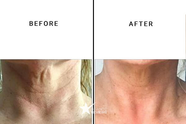 It Cosmetics Neck Firming Cream Before and After