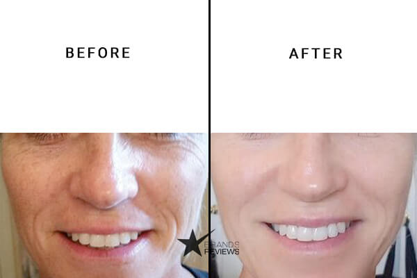 Jan Marini Peptide Serum Before and After