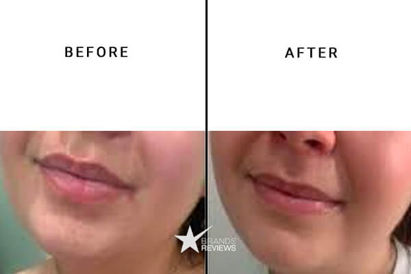 Joy Organics CBD Lip Balm Before and After