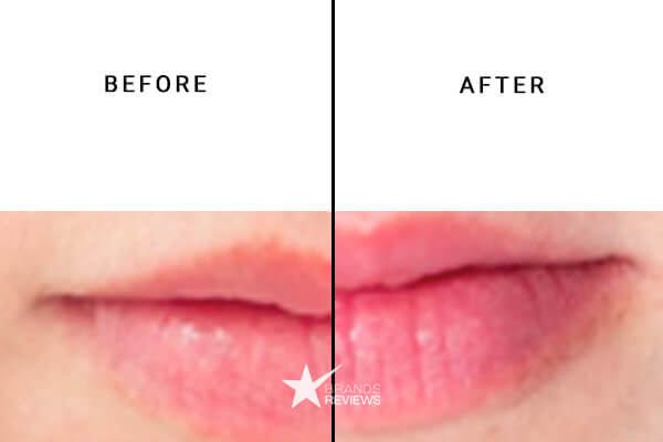 Just Live CBD Lip Balm Before and After