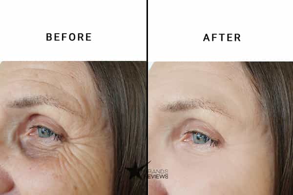 Kiehl's Anti-Aging Serum Before and After