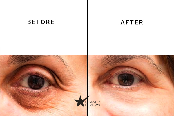Kiehl's Eye Cream Before and After