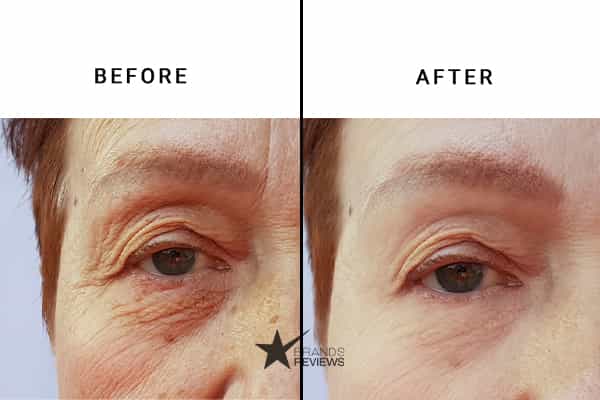 L'Oreal Paris Anti-Aging Serum Before and After