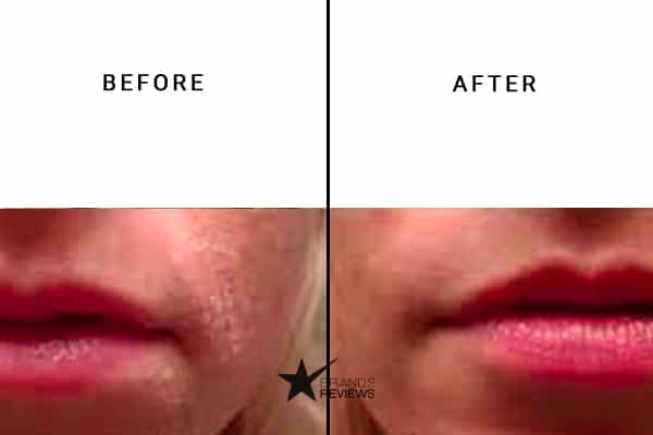 L'oreal Paris Face Moisturizer Before and After