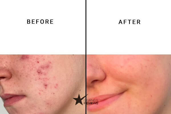 L'Oreal Paris Vitamin C Serum Before and After