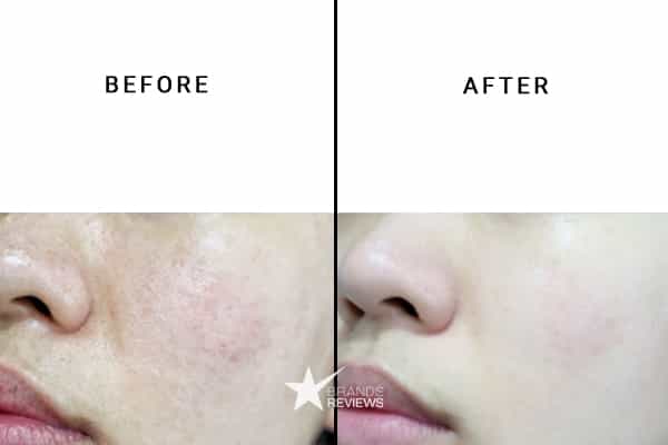 L'Oreal Paris Hyaluronic Acid Serum Before and After