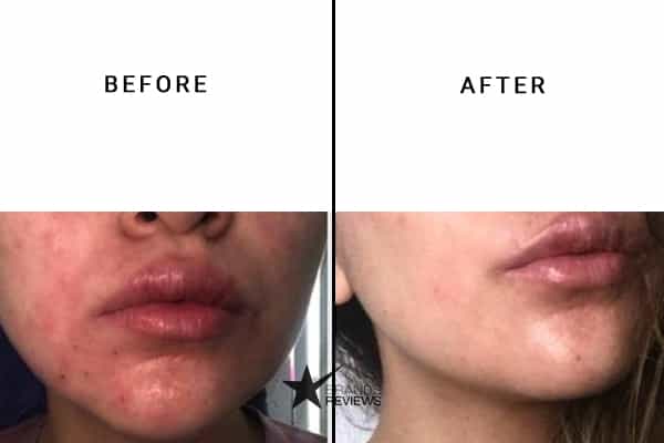 LA MER Face Moisturizer Before and After
