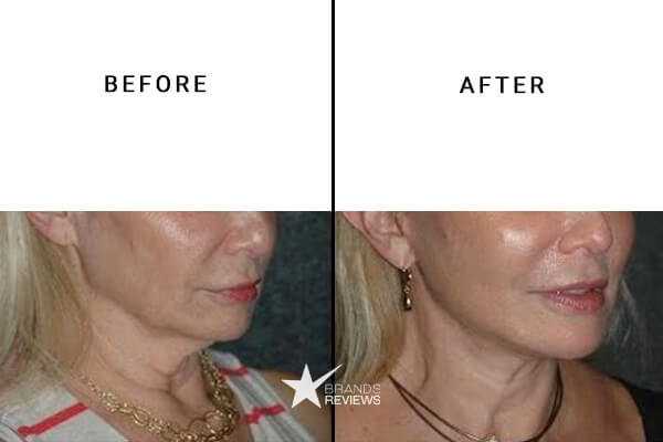 La Mer Neck Firming Cream Before and After