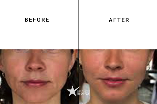 La Prairie Anti-Aging Serum Before and After