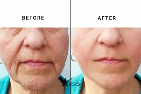La Roche-Posay Anti-Aging Serum Before and After