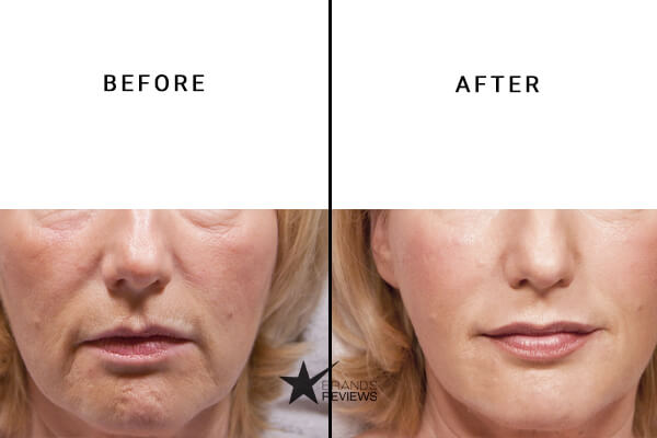 La Roche-Posay Antioxidant Serum Before and After