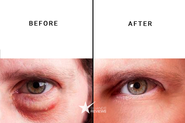 Lavelier Eye cream Before and After