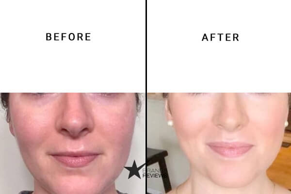 Lord Jones cbd Face Cream Before and After