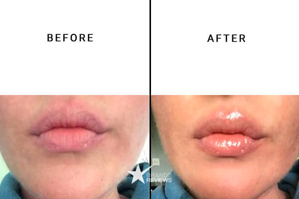 Lord Jones CBD Lip Balm Before and After