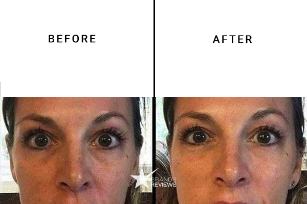 LuxeBiotics Eye Cream Before and After