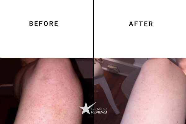 MedAims CBD Body Lotion Before and After