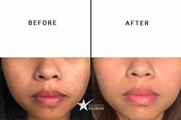 Murad Collagen Serum Before and After