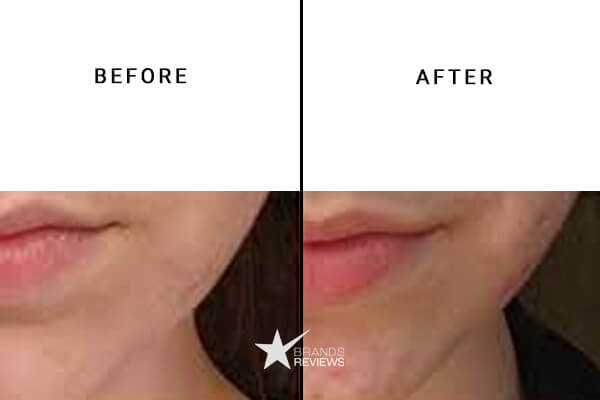 NanoCraft CBD Lip Balm Before and After