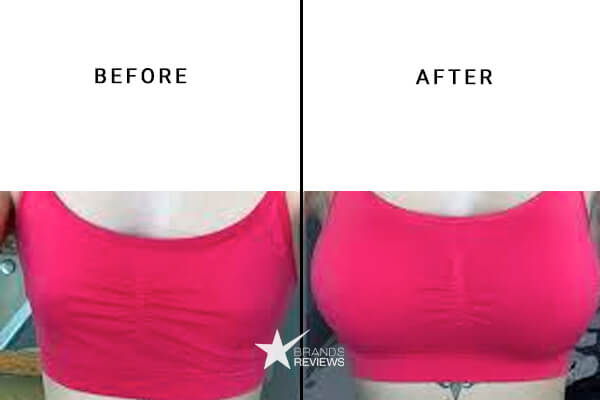 Naturaful Breast Enlargement Before and After