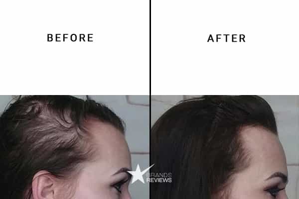 Nature's Nutrition Hair Gummies Before and After
