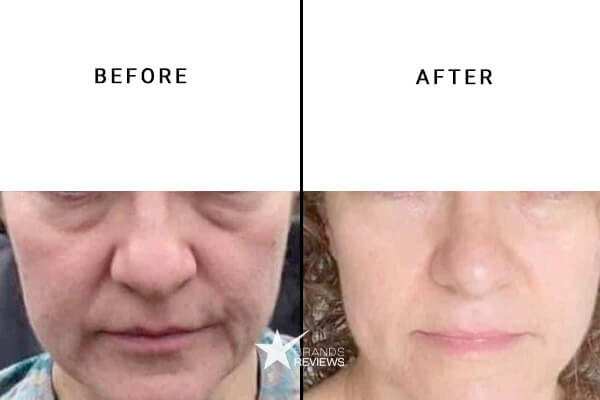 NcN Skincare Peptide Serum Before and After
