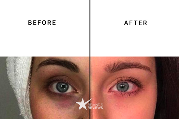 Neocutis Eye Cream Before and After