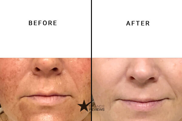 Neogen Vitamin C Serum Before and After