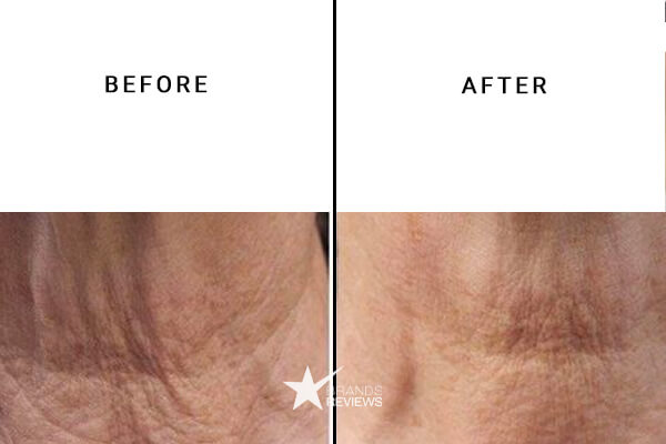 NeoStrata Neck Firming Cream Before and After