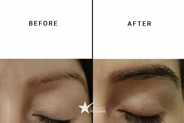 Neubrow Eyebrow Growth Serum Before and After