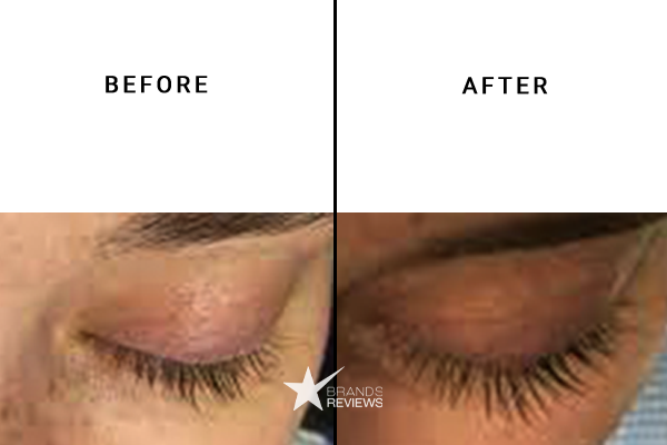 NeuLASH Eyelash Serum Before and After