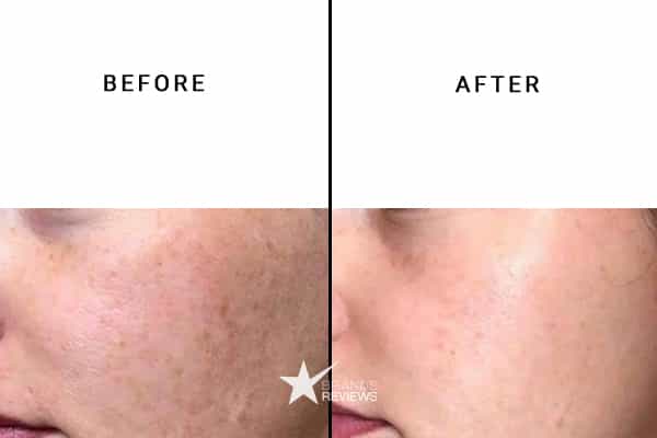 Neutrogena Hyaluronic Acid Serum Before and After