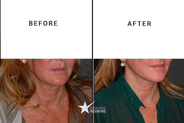 NO 7 Neck Firming Cream Before and After
