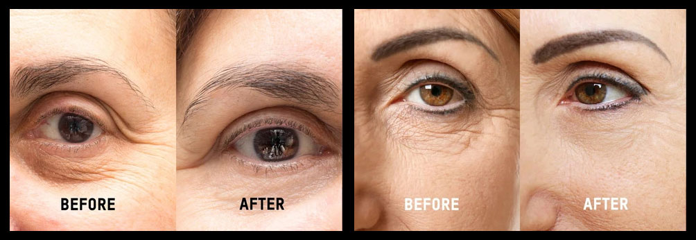 NourishMax Eye Cream Before and After