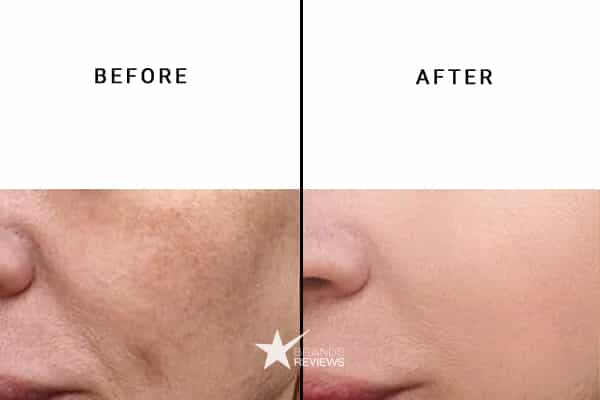 Nourishmax Collagen Serum Before and After