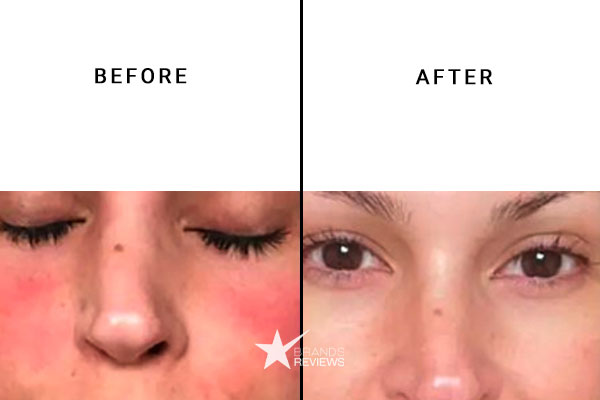 NourishMax Facial Toner Before and After