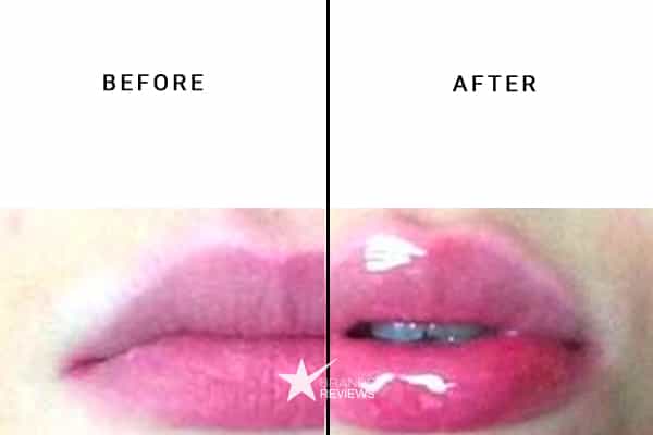 NourishMax Lip Plumper Before and After