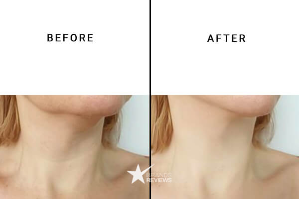 NourishMax Neck Firming Cream Before and After